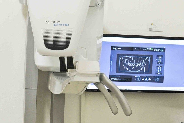 digitales röntgen